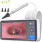Otoscope Ear Camera with 4.5" IPS Screen, 1920X1080 FHD Smart Visual Ear Wax Removal Tool Camera Kit, 32GB Card Ear Scope Otoscope with Light, Plug & Play at Home Ear Infection Detector
