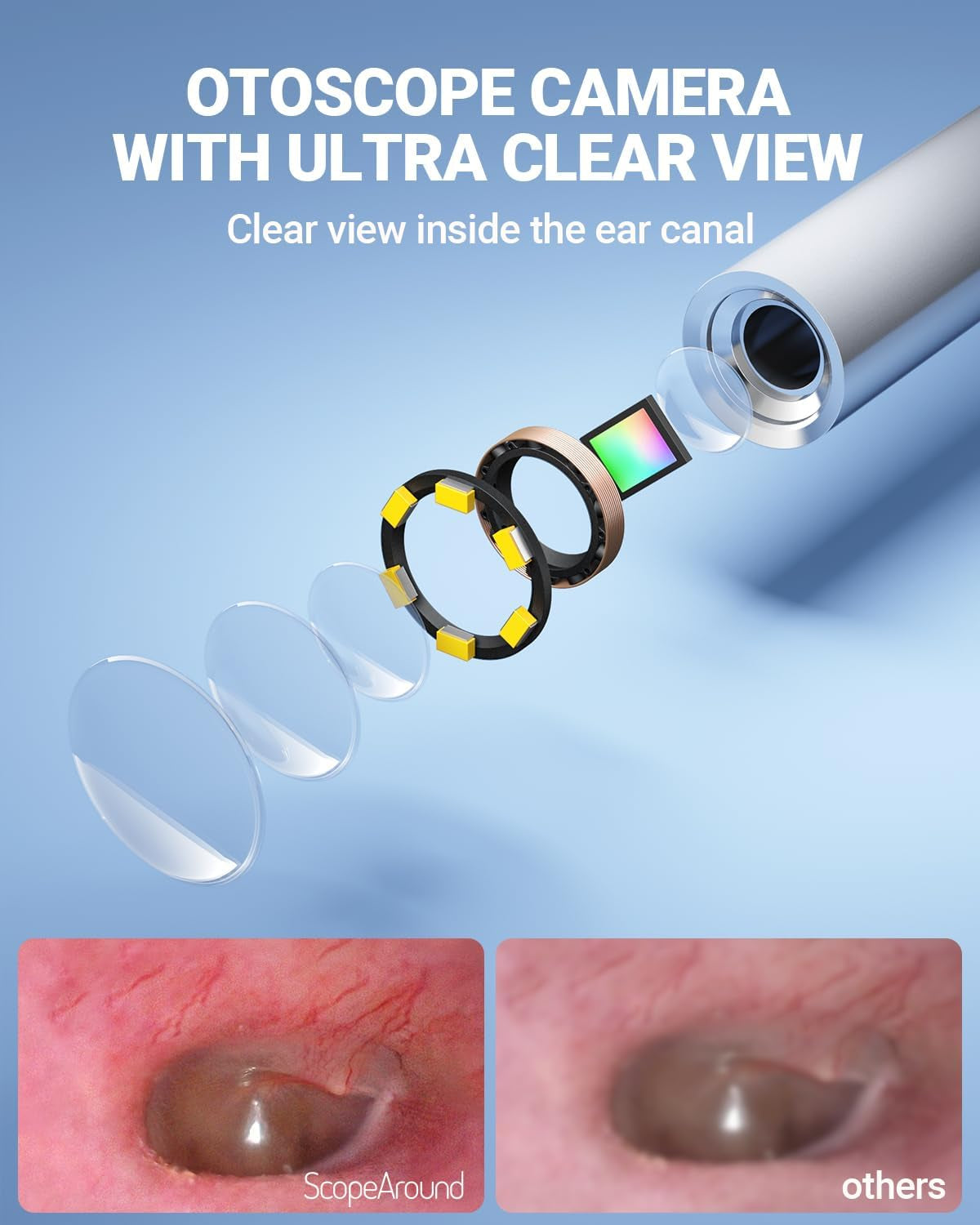 Otoscope Ear Camera with 4.5" IPS Screen, 1920X1080 FHD Smart Visual Ear Wax Removal Tool Camera Kit, 32GB Card Ear Scope Otoscope with Light, Plug & Play at Home Ear Infection Detector