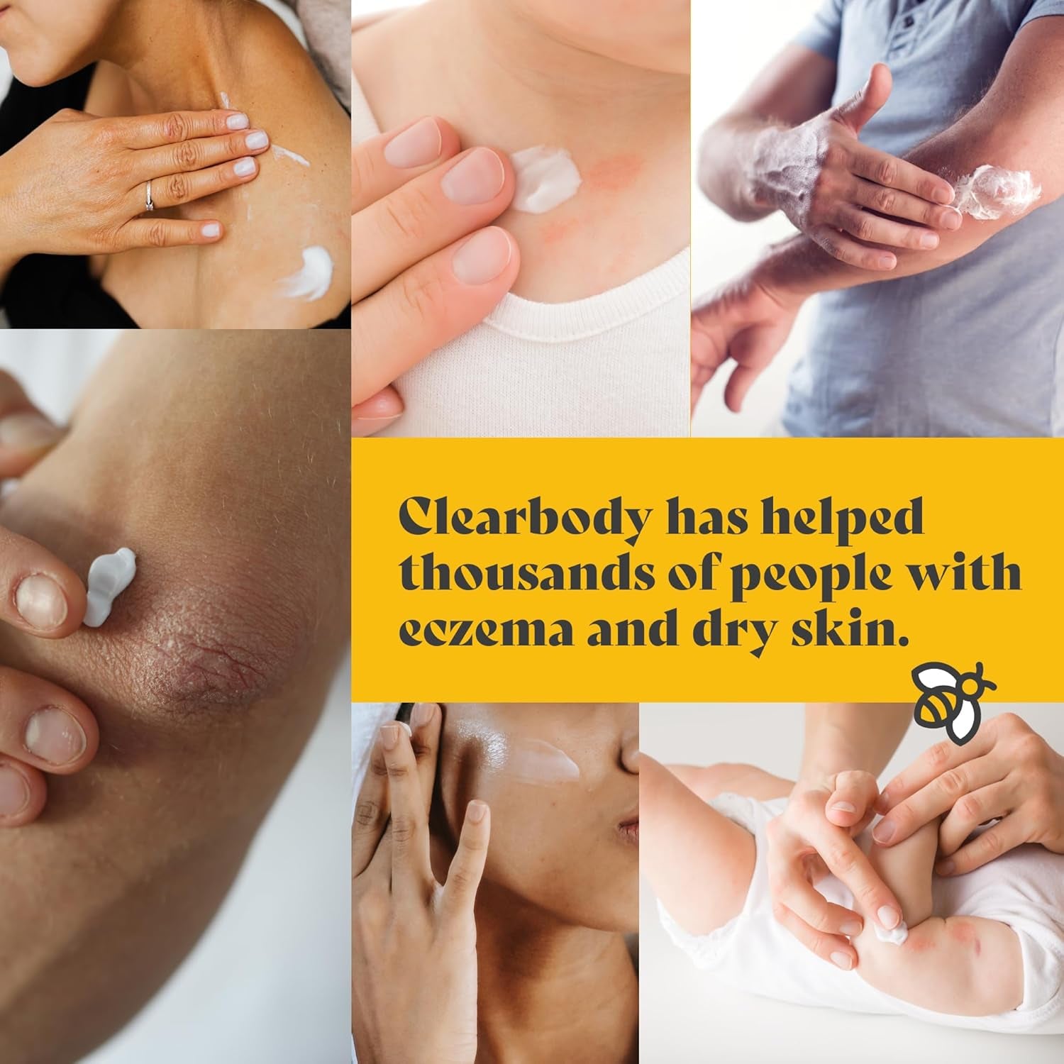 Clearbody Manuka Honey Eczema Cream – Organic Eczema Honey & Collodial Oatmeal Moisturizer for Soothing, Eczema, Dry & Itchy Skin – Face & Body Eczema Lotion - Plant-Based Formula (2Oz)